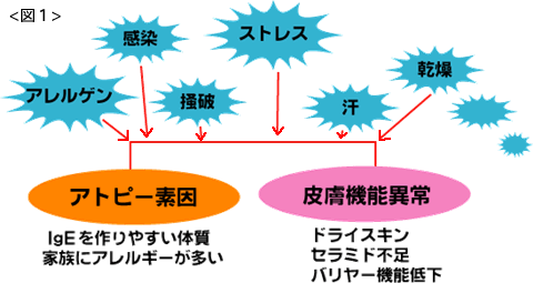 アトピー性皮膚炎の原因