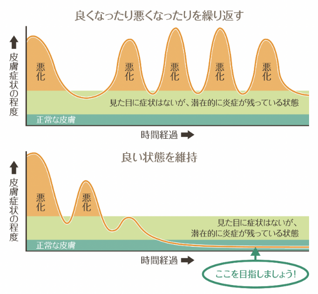 アトピー性皮膚炎の経過と治療目標